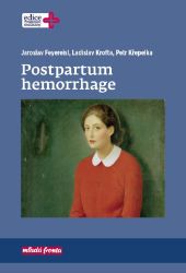 Postpartum hemorrhage - Ladislav Krofta,Petr Křepelka,Jaroslav Feyereisl - Zdraví, hubnutí a sport Postpartum hemorrhage