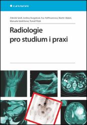 Radiologie pro studium i praxi - Manuela Vaněčková,Zdeněk Seidl,Andrea Burgetová,Eva Hoffmannová,Tomáš Viták,Martin Mašek - Medicína a lékařství Radiologie pro studium i praxi