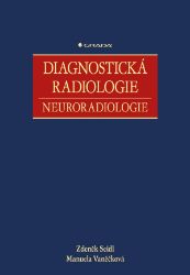 Diagnostická radiologie - Manuela Vaněčková,Zdeněk Seidl - Medicína a lékařství Diagnostická radiologie