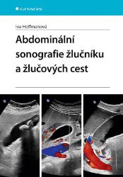 Abdominální sonografie žlučníku a žlučových cest - Iva Hoffmanová - Medicína a lékařství Abdominální sonografie žlučníku a žlučových cest