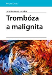 Trombóza a malignita Trombóza a malignita