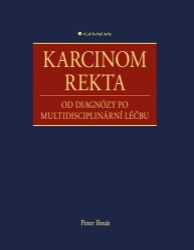 Karcinom rekta Karcinom rekta