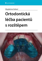 Ortodontická léčba pacientů s rozštěpem Ortodontická léčba pacientů s rozštěpem