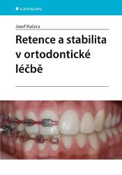 Retence a stabilita v ortodontické léčbě - Josef Kučera - Medicína a lékařství Retence a stabilita v ortodontické léčbě