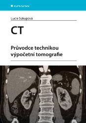 CT - Průvodce technikou výpočetní tomografie CT - Průvodce technikou výpočetní tomografie