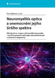 Neuromyelitis optica a onemocnění jejího širšího spektra Neuromyelitis optica a onemocnění jejího širšího spektra