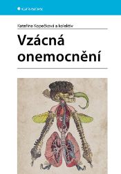 Vzácná onemocnění - Kateřina Kopečková - Medicína a lékařství Vzácná onemocnění