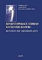 Revizní operace náhrad kyčelního kloubu - Martin Krbec,Pavel Douša,Valér Džupa - Zdraví, hubnutí a sport Revizní operace náhrad kyčelního kloubu