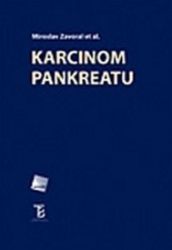 Karcinom pankreatu Karcinom pankreatu