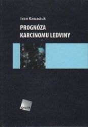 Prognóza karcinomu ledviny Prognóza karcinomu ledviny