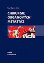 Chirurgie orgánových metastáz Chirurgie orgánových metastáz