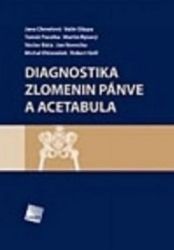 Diagnostika zlomenin pánve a acetabula Diagnostika zlomenin pánve a acetabula