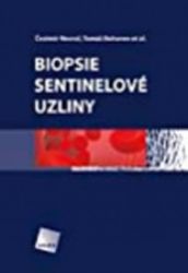 Biopsie sentinelové uzliny - Adrián Macho - Medicína a lékařství Biopsie sentinelové uzliny