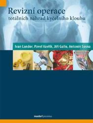 Revizní operace totálních náhrad kyčelního kloubu - kolektiv autorů,Ivan Landor - Zdraví, hubnutí a sport Revizní operace totálních náhrad kyčelního kloubu
