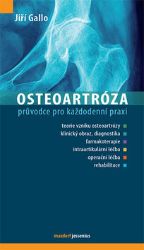 Osteoartróza Osteoartróza