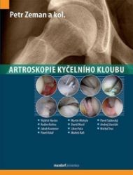 Artroskopie kyčelního kloubu Artroskopie kyčelního kloubu