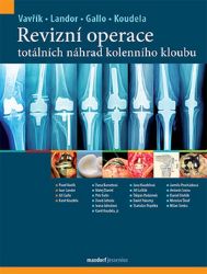 Revizní operace totálních náhrad kolenního kloubu - Pavel Vavřík - Zdraví, hubnutí a sport Revizní operace totálních náhrad kolenního kloubu