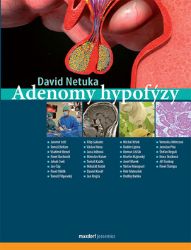 Adenomy hypofýzy Adenomy hypofýzy