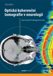 Optická koherenční tomografie v neurologii - kolektiv autorů,Jana Lízrová Preiningerová - Zdraví, hubnutí a sport Optická koherenční tomografie v neurologii