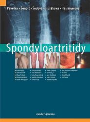 Spondyloartritidy Spondyloartritidy