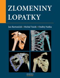 Zlomeniny lopatky Zlomeniny lopatky