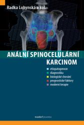 Anální spinocelulární karcinom Anální spinocelulární karcinom