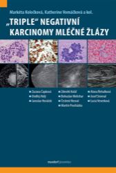 „Triple“ negativní karcinomy mléčné žlázy „Triple“ negativní karcinomy mléčné žlázy