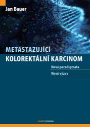 Metastazující kolorektální karcinom - Nová paradigmata, nové výzvy - Jan Bauer - Medicína a lékařství Metastazující kolorektální karcinom - Nová paradigmata, nové výzvy