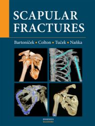 Scapular fractures - Ondřej Naňka,Jan Bartoníček,Michal Tuček,Christopher L. Colton - Knihy o módě, umění a designu v angličtině Scapular fractures