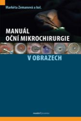 Manuál oční mikrochirurgie v obrazech - Hana Wagnerová,Markéta Zemanová - Výživa a zdravý životní styl Manuál oční mikrochirurgie v obrazech