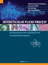 Intersticiální plicní procesy Intersticiální plicní procesy