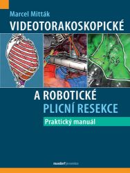 Videotorakoskopické a robotické plicní resekce - Marcel Mitták - Medicína a lékařství Videotorakoskopické a robotické plicní resekce