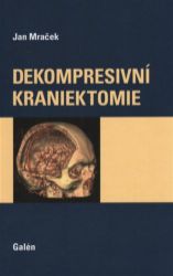Dekompresivní kraniektomie - Jan Mraček - Medicína a lékařství Dekompresivní kraniektomie