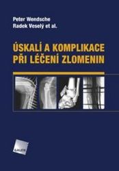 Úskalí a komplikace při léčení zlomenin Úskalí a komplikace při léčení zlomenin