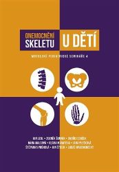 Onemocnění skeletu u dětí Onemocnění skeletu u dětí