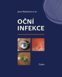 Oční infekce Oční infekce