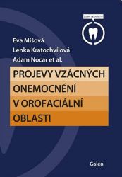 Projevy vzácných onemocnění v orofaciální oblasti - Eva Míšová,Adam Nocar,Lenka Kratochvílová - Medicína a lékařství Projevy vzácných onemocnění v orofaciální oblasti