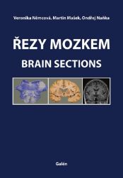 Řezy mozkem / Brain Sections Řezy mozkem / Brain Sections