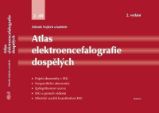 Atlas elektroencefalografie dospělých 2. díl Atlas elektroencefalografie dospělých 2. díl