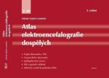 Atlas elektroencefalografie dospělých 2. díl - Zdeněk Vojtěch - Medicína a lékařství Atlas elektroencefalografie dospělých 2. díl