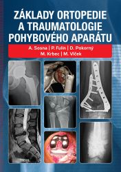 Základy ortopedie a traumatologie pohybového aparátu - Martin Krbec,Antonín Sosna,David Pokorný,Martin Vlček,Petr Fulín - Výživa a zdravý životní styl Základy ortopedie a traumatologie pohybového aparátu