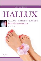 Hallux - Řešení bez operace Hallux - Řešení bez operace