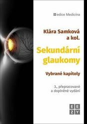 Sekundární glaukomy - Vybrané kapitoly Sekundární glaukomy - Vybrané kapitoly