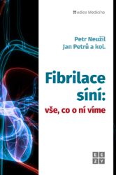 Fibrilace síní: vše, co o ní víme