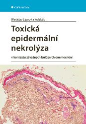 Toxická epidermální nekrolýza - Zdravotnická a lékařská literatura e-knihy Toxická epidermální nekrolýza