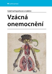 Vzácná onemocnění Vzácná onemocnění