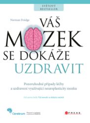 Váš mozek se dokáže uzdravit Váš mozek se dokáže uzdravit