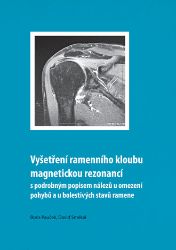 Vyšetření ramenního kloubu magnetickou rezonancí s podrobným popisem nálezů u omezení pohybů u bolestivých stavů ramene - Dějiny, fakta a historie Vyšetření ramenního kloubu magnetickou rezonancí s podrobným popisem nálezů u omezení pohybů u bolestivých stavů ramene