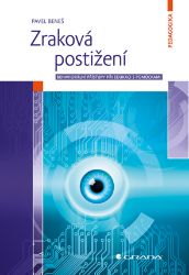 Zraková postižení Zraková postižení