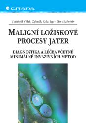 Maligní ložiskové procesy jater - Igor Kiss - Lékařská literatura e-knihy Maligní ložiskové procesy jater